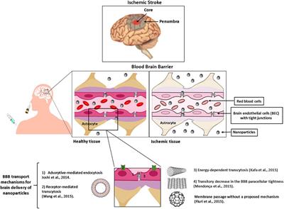 Recent Advances in the Therapeutic and Diagnostic Use of Liposomes and Carbon Nanomaterials in Ischemic Stroke